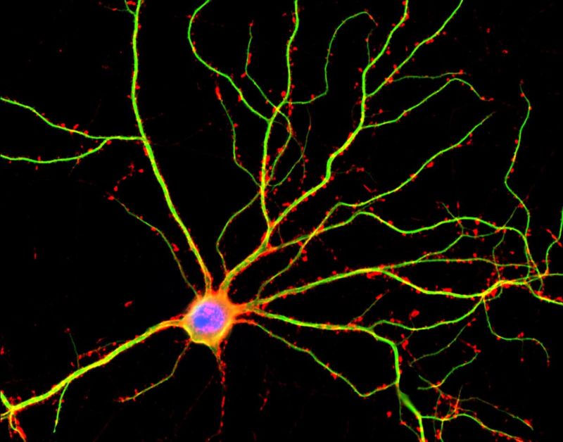 Image of a neuron