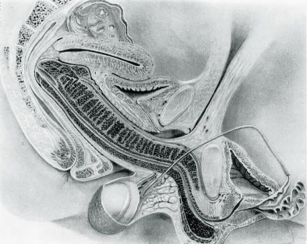 X ray of penis inside vagina