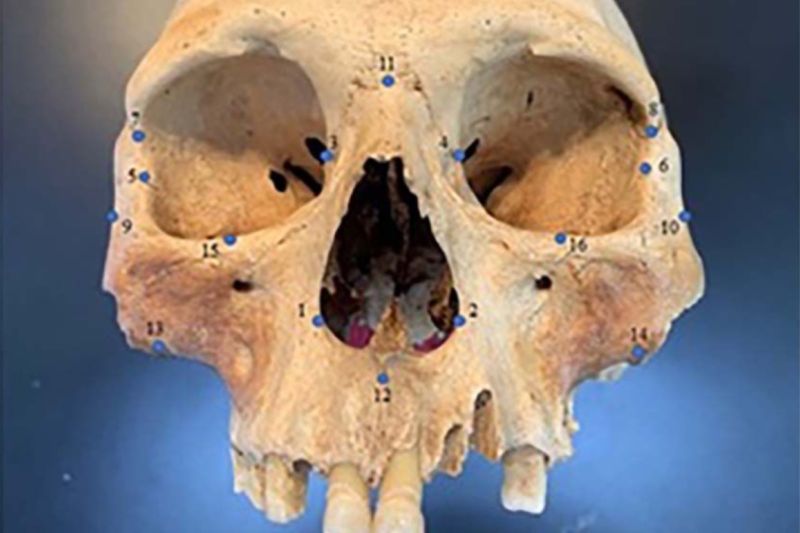 Earlier this year, researchers analyzed the skulls of early Caribbean inhabitants, using 3D facial "landmarks" as a genetic proxy for determining how closely people groups were related to one another. A follow-up study this month added ancient DNA analysis into the mix, with conflicting results.