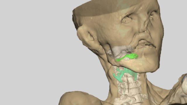 In 2016 Italian scientists reconstructed Ötzi the Iceman’s vocal tract.