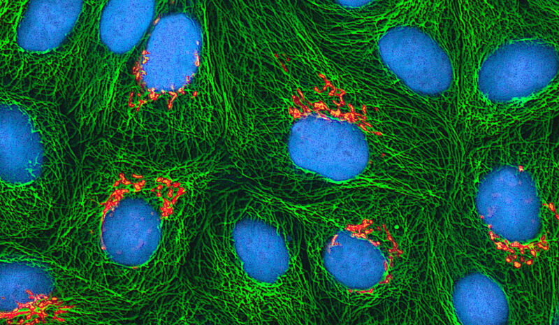 Image of blue ovals surrounded by a glowing green mesh.