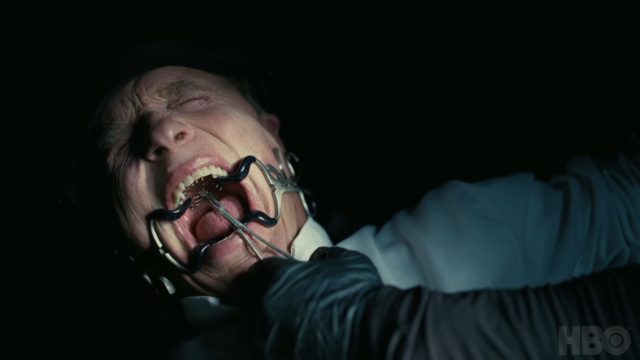 Image of the worst dentist visit ever