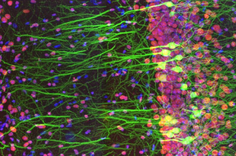 Detail from the winning entry in the first Olympus Global Image of the Year Life Science Light Microscopy Award. It shows immunostaining of a mouse-brain slice with two fluorophores.
