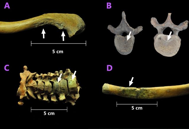 A. These growths on the collarbone suggest that the man carried heavy loads on his shoulders. B. This vertebra shows early signs of wear and tear. C and D: Green coloration acquired by contact with copper on the cervical vertebrae and a rib.