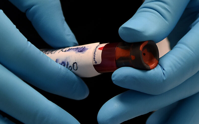 Extreme closeup photo of gloved hands holding a test tube.