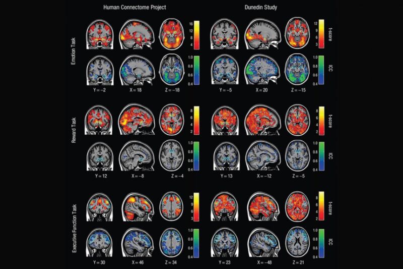 A new review study has bad news for scientists keen on using task-oriented fMRI to draw conclusions about any one person's brain.