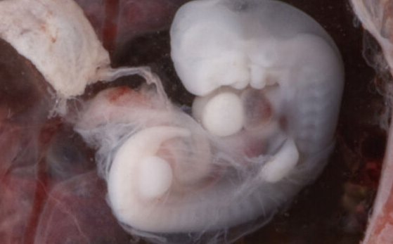 The repeated light and dark pattern you can see down the side of this embryo is caused by the presence of somites.