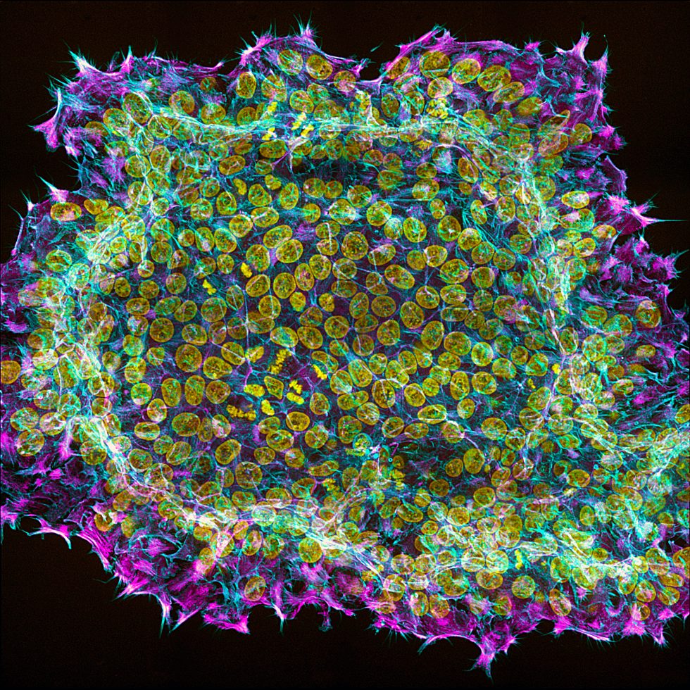 Bats, bugs, and beauty: The best microscopy images of 2020 - Ars Technica