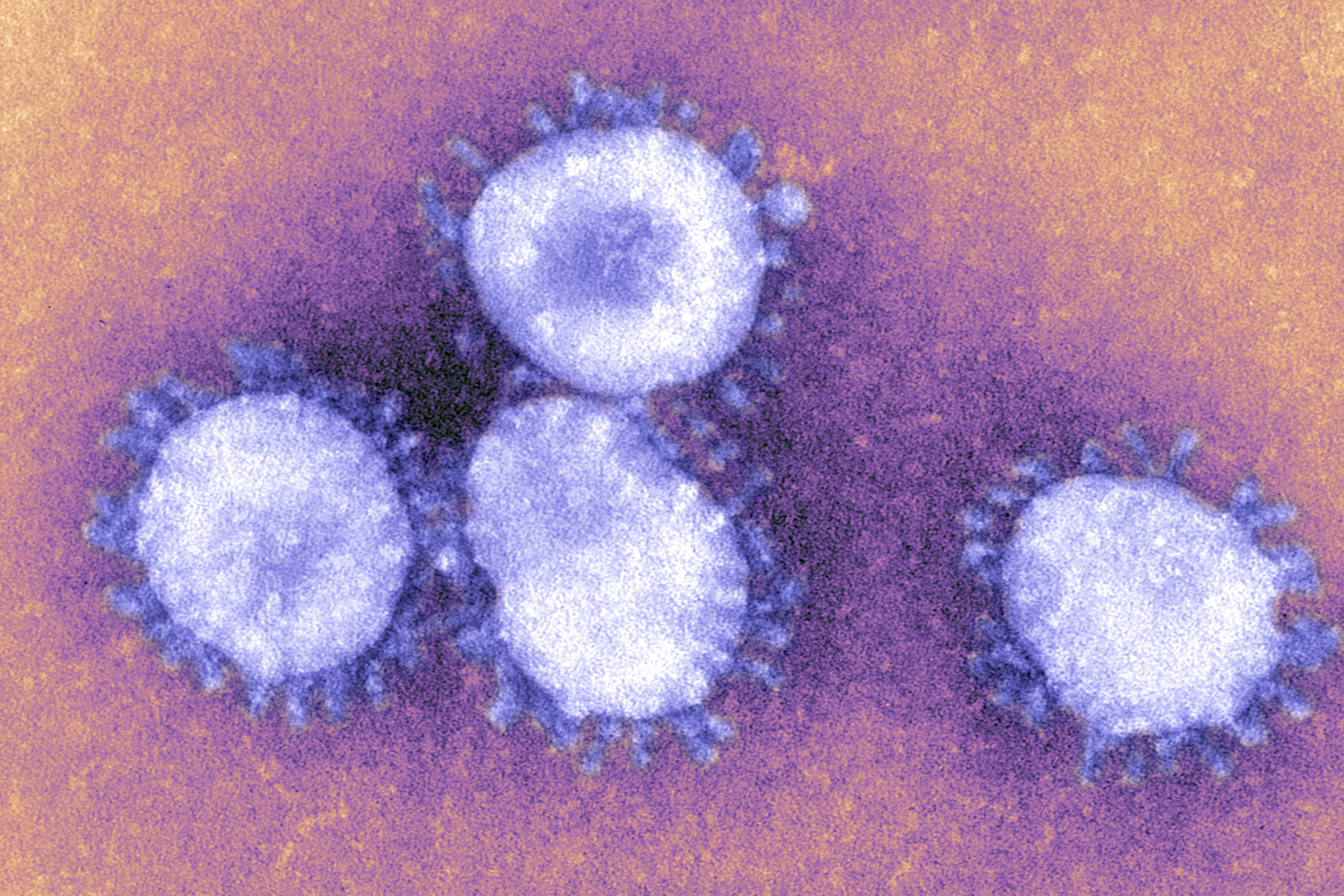 Коронавирус года появился. Вирус коронавирус под микроскопом. Коронавирус 2019 под микроскопом. Микрофотография вируса коронавирус. Коронавирус в микроскопе.