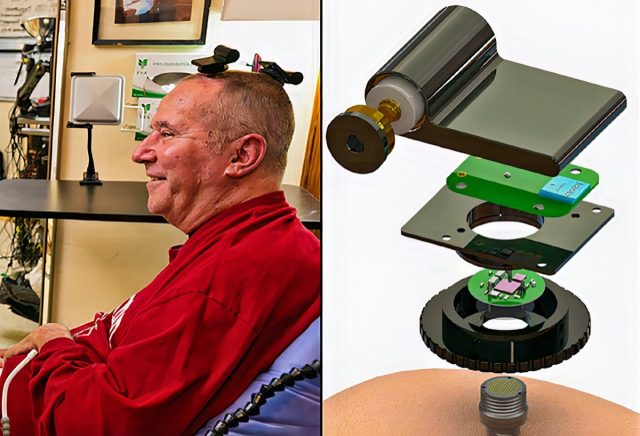 (l) A participant in the BrainGate clinical trial uses wireless transmitters that replace the cables normally used to transmit signals from sensors inside the brain. (r) The wireless device enables transmission of full-broadband brain signals while consuming a small amount of power. Batteries last for up to 36 hours.