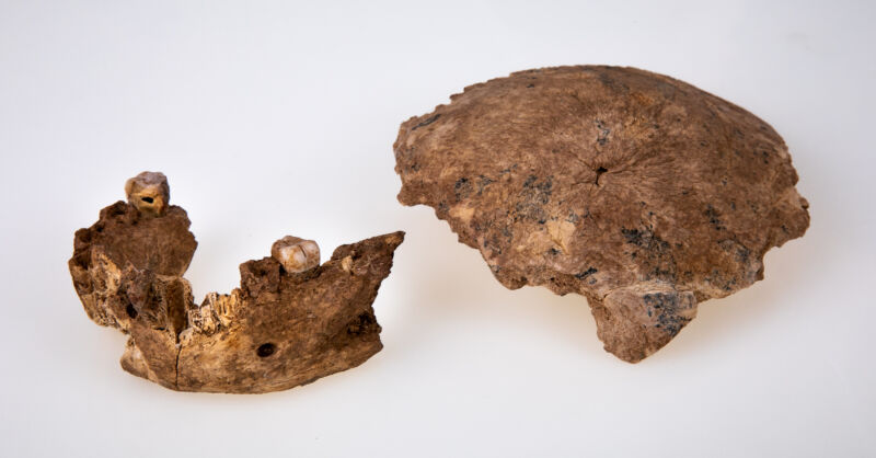 Technology Image of pieces of an ancient skull.
