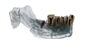 成像还捕捉到了颌骨的内部特征。
