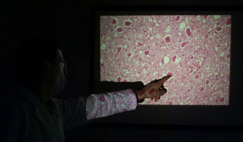 An arm points to a video projection of raw pink goo.