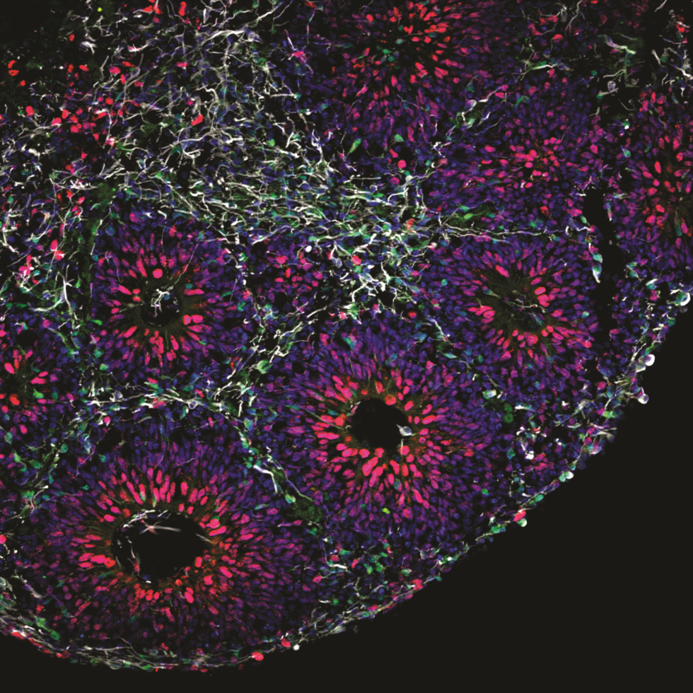 Organoids are three dimensional tissues grown in culture that help us understand the development of normal tissues.