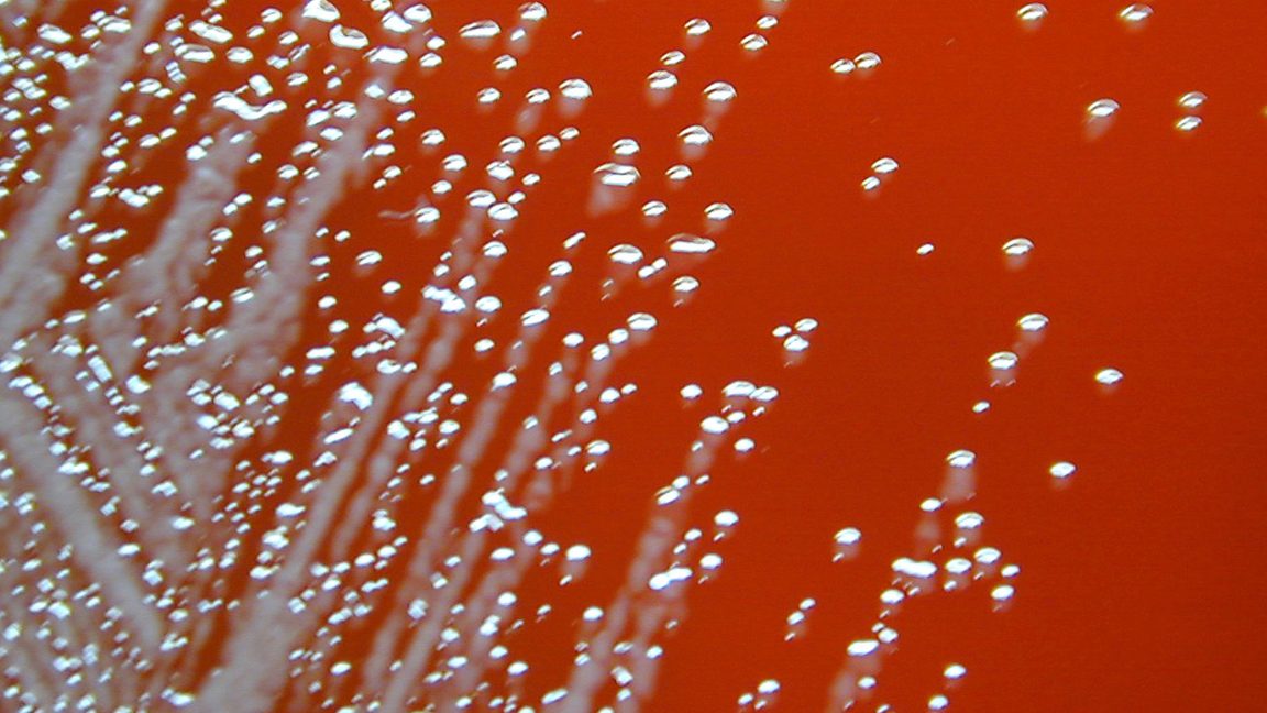 Two men fell gravely ill last year; their infections link to deaths in the ’80s