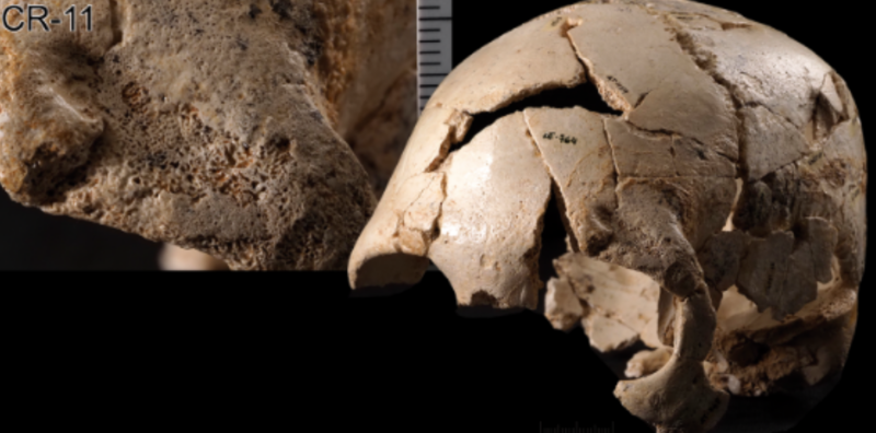 Early humans kept getting their heads knocked in