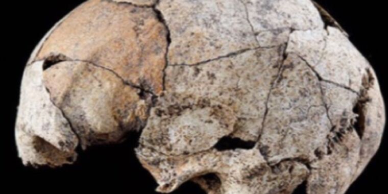 This 5,300-year-old skull shows evidence of the earliest known ear surgery