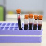 A plastic tray holds vials of blood upright.