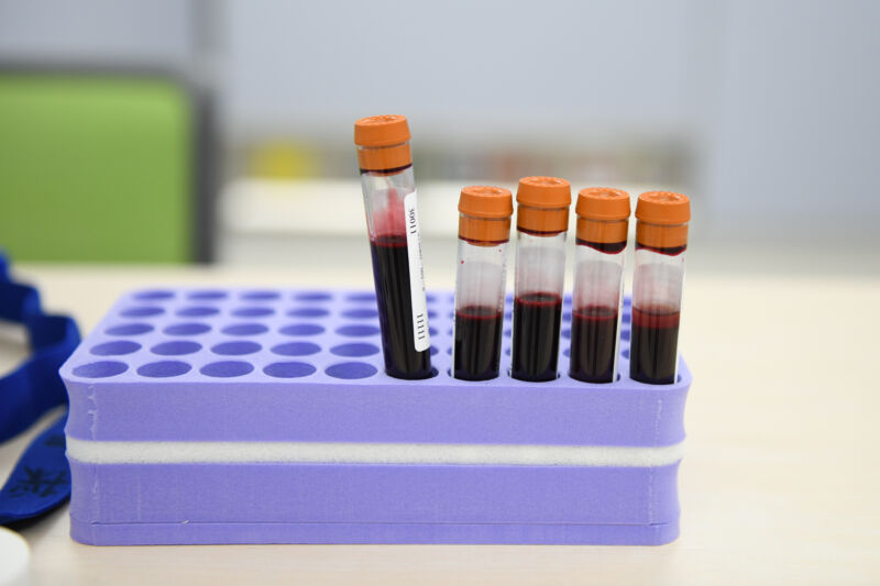 A plastic tray holds vials of blood upright.