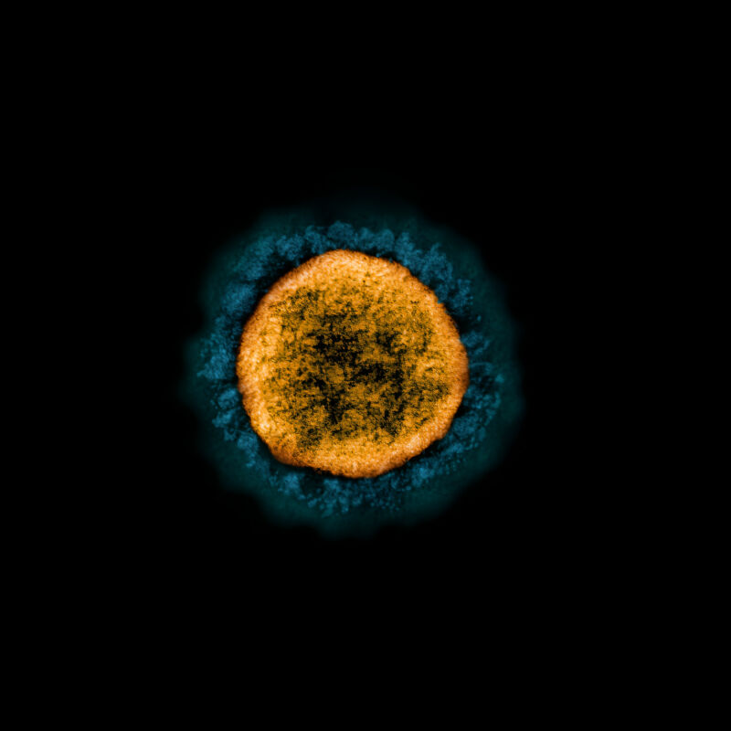 Transmission electron micrograph of a SARS-CoV-2 virus particle isolated from a patient sample and cultivated in cell culture.