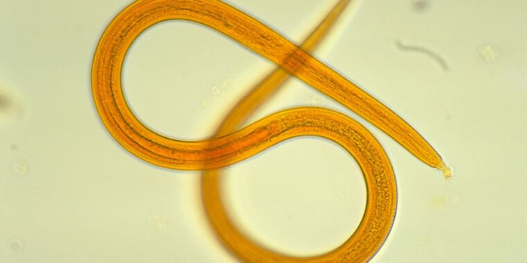 Army of worm larvae hatch from man’s bum, visibly slither under his skin