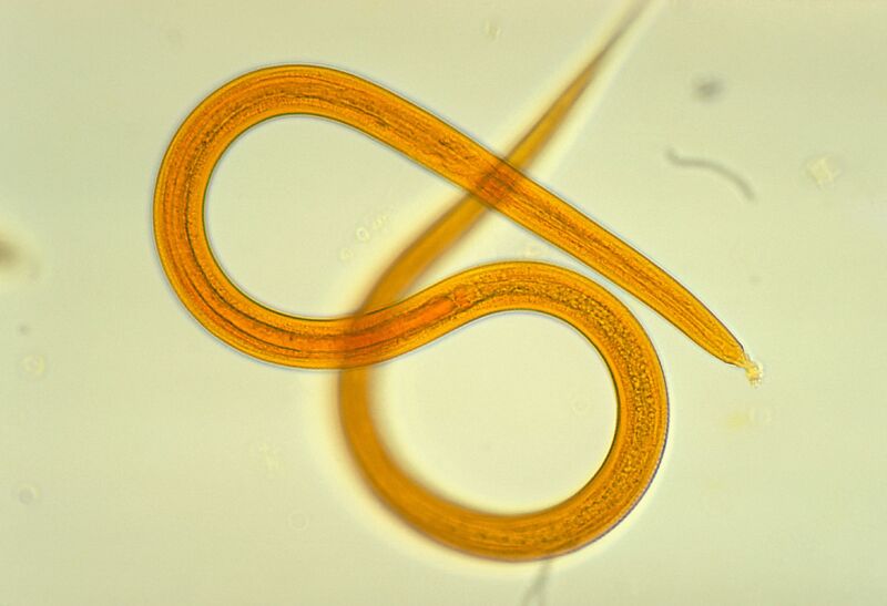 A <em>Strongyloides filariform</em> larva.