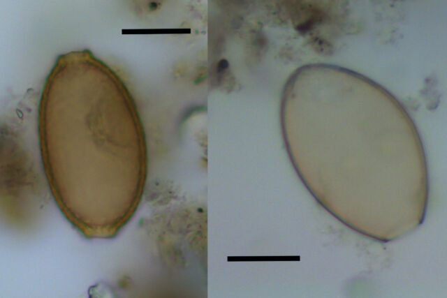 (left) Microscopic egg of capillariid worm from Durrington Walls. (right) Microscopic egg of fish tapeworm found in dog coprolite.