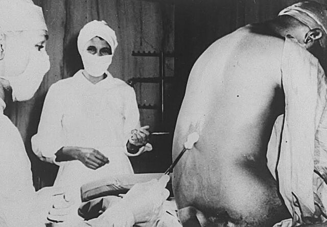 Dr. Jesse Peters and Nurse Eunice Rivers perform a lumbar puncture on an unidentified study participant in 1933.