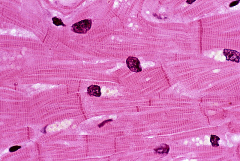 Image of long arrays of cells stained pink.