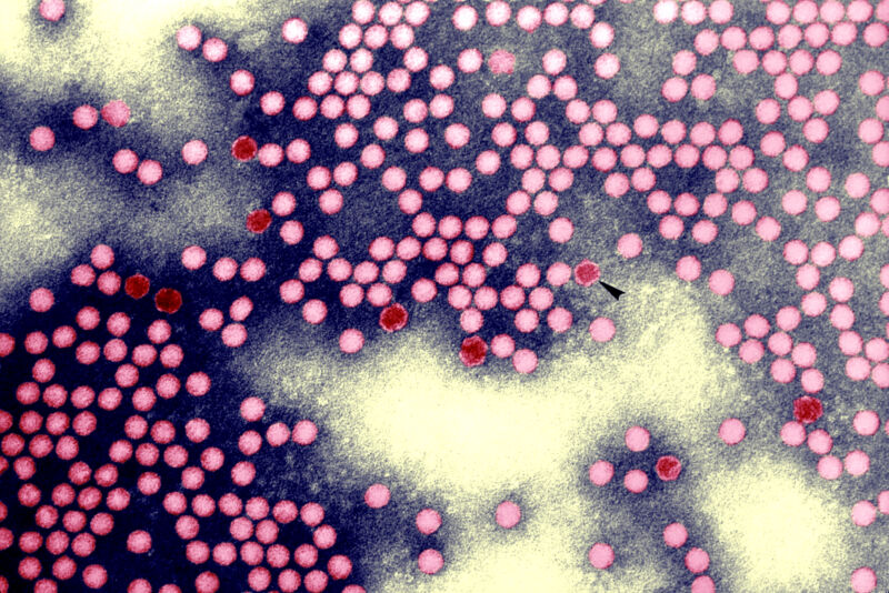 Transmissie-elektronenmicrofoto van poliovirus type 1.