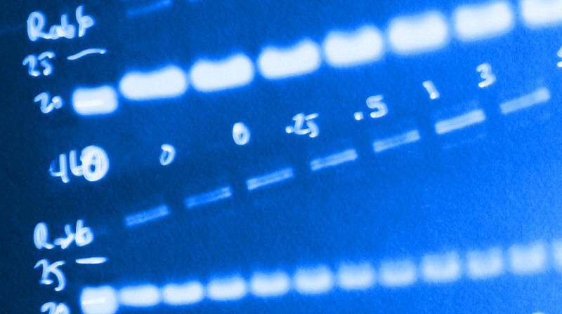 Negative photo image of a western blot test result.