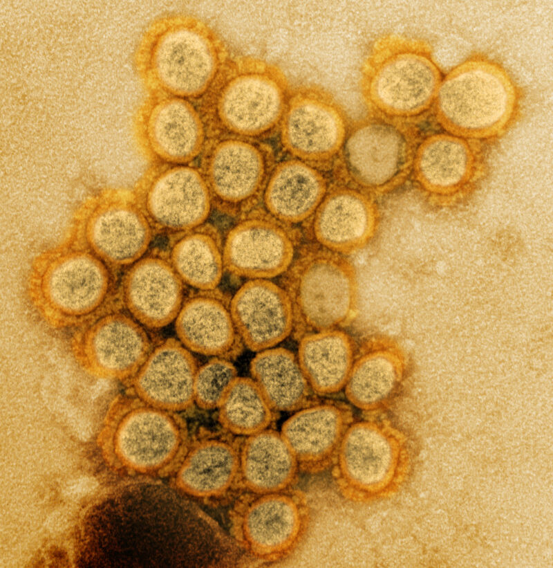 Transmission electron micrograph of a variant strain of SARS-CoV-2 virus particles (UK B.1.1.7), isolated from a patient sample and cultivated in cell culture. Image captured at the NIAID Integrated Research Facility (IRF) in Fort Detrick, Maryland.