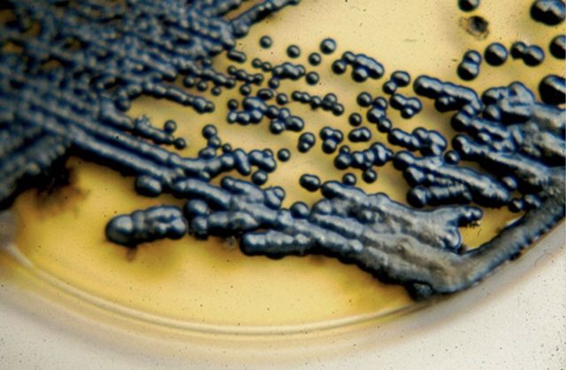 Culture of <em>Hortaea werneckii</em> on SGA. Two phases: yeast-like phase with moist colonies, and a filamentous colony.