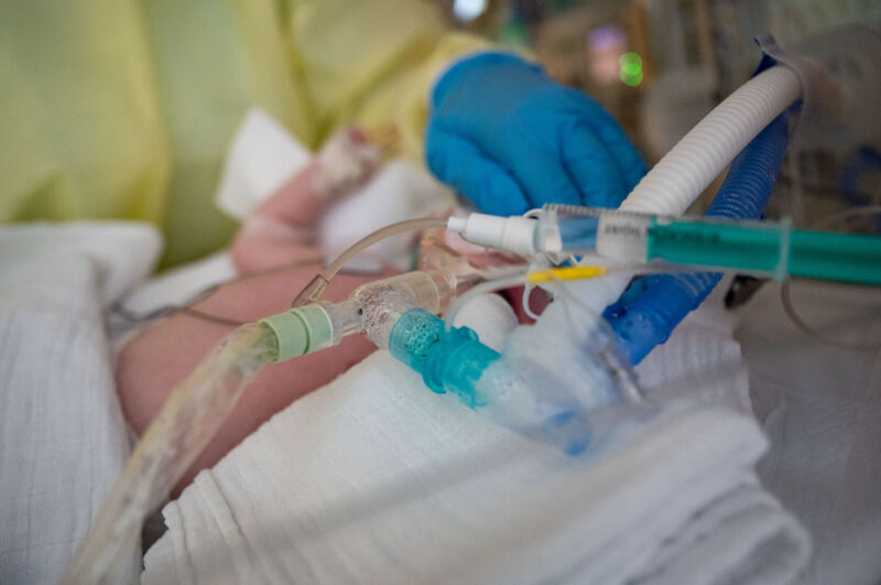 An intensive care nurse cares for a patient suffering from respiratory syncytial virus (RSV), who is being ventilated in the children's intensive care unit of the Olga Hospital of the Stuttgart Clinic in Germany.