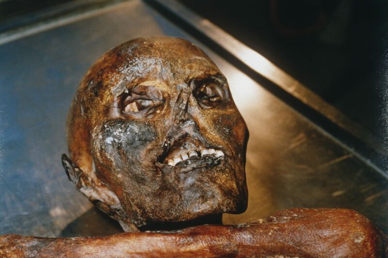 The mummified corpse of Ötzi the Iceman, discovered in 1991.