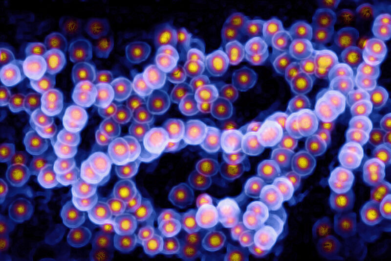 A microscope image of <em>Streptococcus pyogenes</em>, a common type of group A strep. 