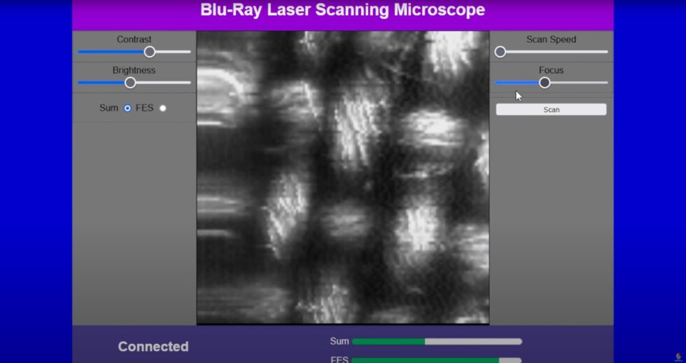 The image Doctor Volt's microscope captured of the piece of fabric. They make adjustments to the image via a Java-based browser interface.