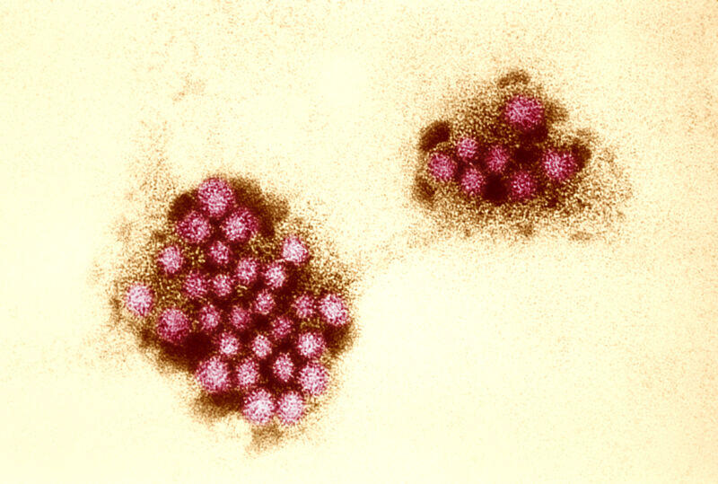 An electron micrograph of norovirus.