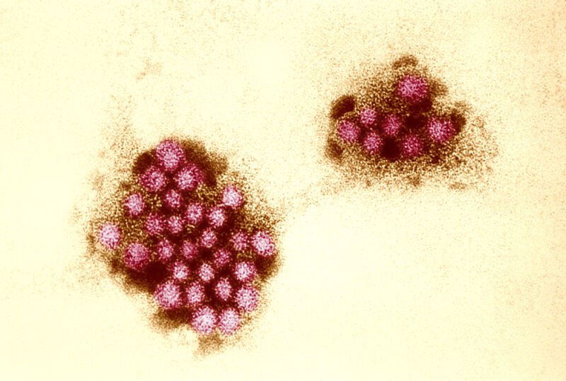 Una micrografía electrónica de norovirus.