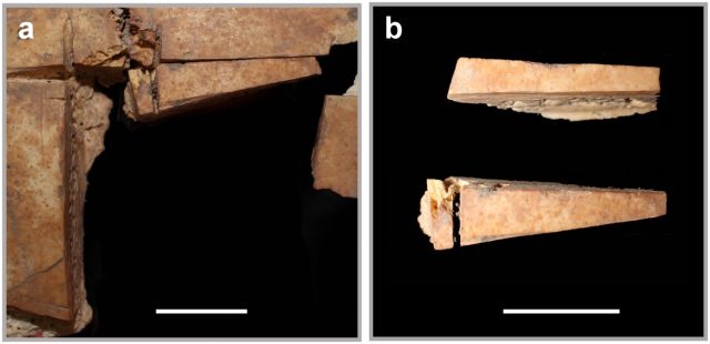 Piezas craneales extirpadas.  Trepanación con pieza craneal extirpada reacondicionada (izquierda).  Ambas piezas existentes encontradas durante el análisis (derecha).