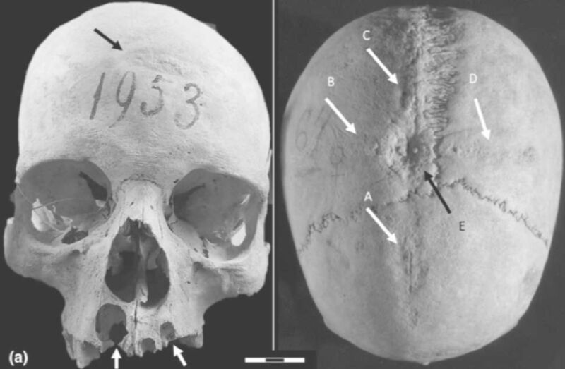 close up images of skull with arrows showing tool marks