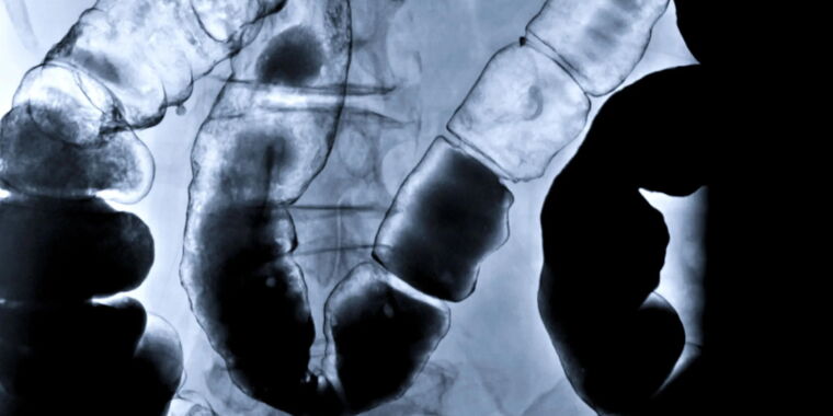 photo of Scientists grew mini human guts inside mice image