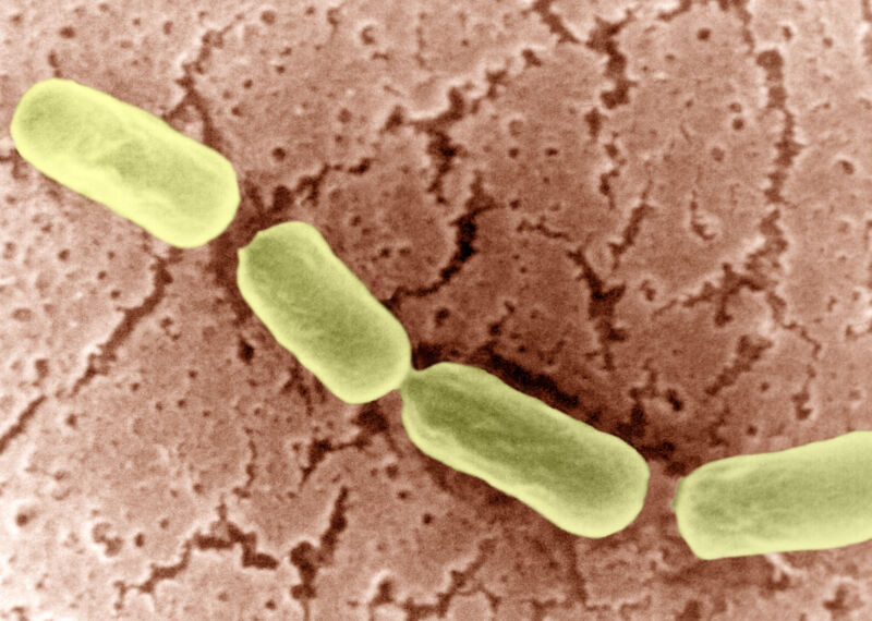 Micrograph of Clostridium botulinum.