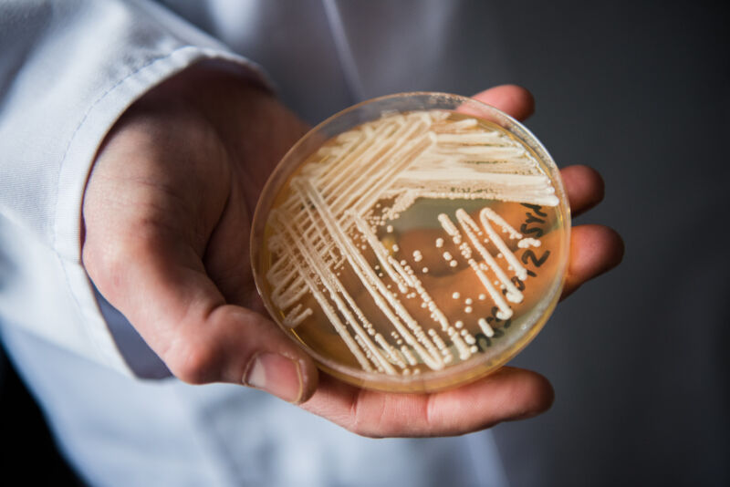 The director of Germany's National Reference Centre for Invasive Fungal Infections holds a petri dish containing the yeast <em>Candida auris</em> in a laboratory at Wuerzburg University.