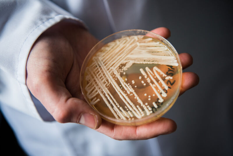 The director of Germany's National Reference Centre for Invasive Fungal Infections holds a petri dish containing the yeast <em>Candida auris</em> in a laboratory at Wuerzburg University. 