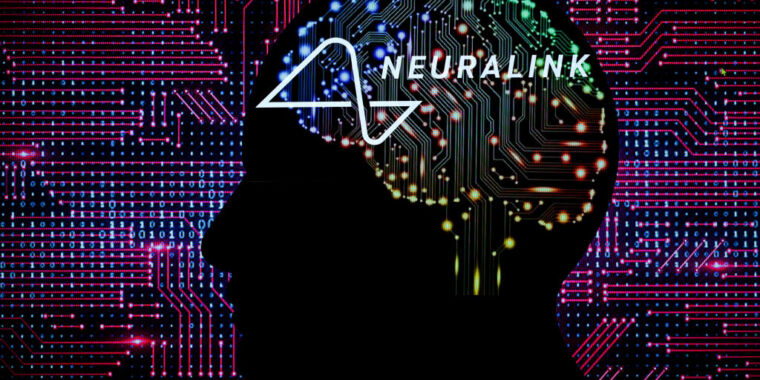 photo of Neuralink says it has the FDA’s OK to start clinical trials image
