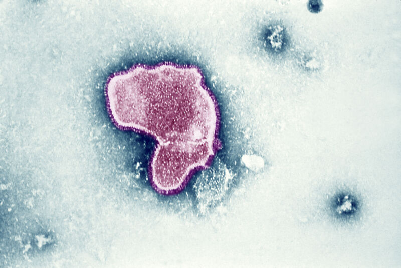 An electron micrograph of the respiratory syncytial virus (RSV).