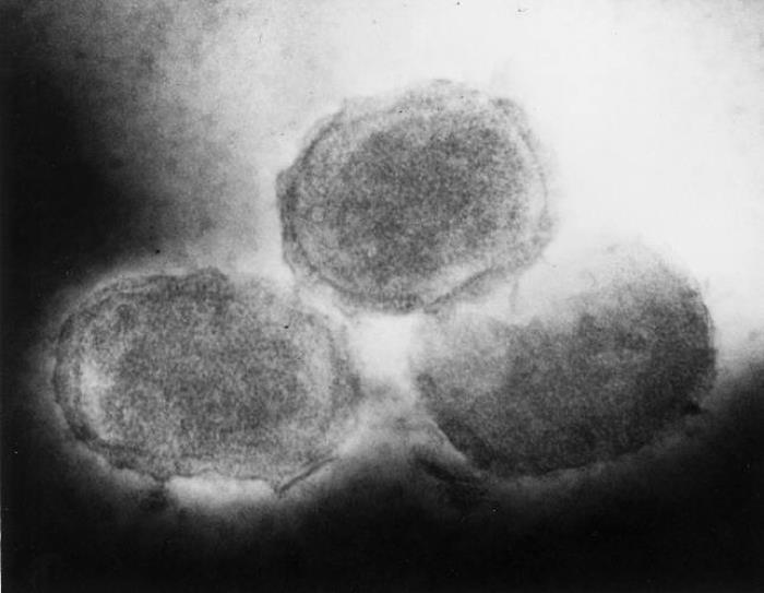 This 1980 transmission electron microscopic (TEM) image revealed some of the ultrastructural morphology exhibited by three poxvirus, molluscum contagiosum virions.