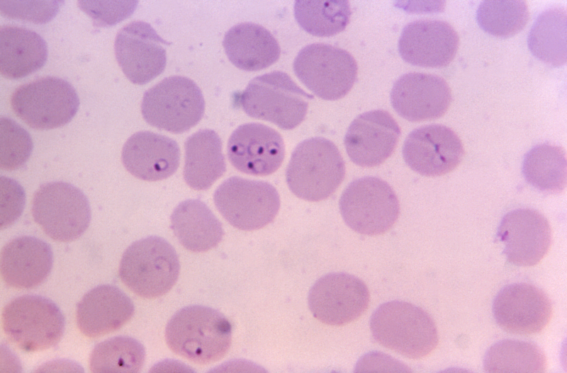 Under a magnification of 1,125x, this photomicrograph of a blood specimen revealed the presence of intraerythrocytic <em>Plasmodium falciparum</em> ring-form trophozoites. Note the erythrocyte in the center contained four ring-staged trophozoites and that all rings exhibited a single chromatin dot.