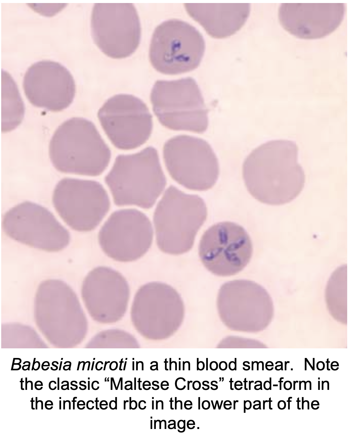 Бабезиоз крс. Babesia microti. Нутталлиоз лошадей микроскопия.